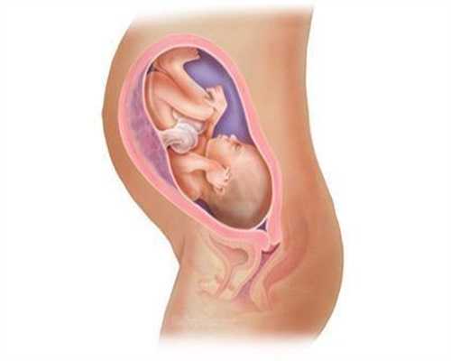 助孕生子流程_做了输卵管腹腔镜怎么护理
