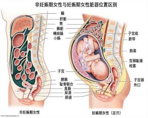 深圳代孕选性别包成功价格_怀孕初期应做的检查有哪些