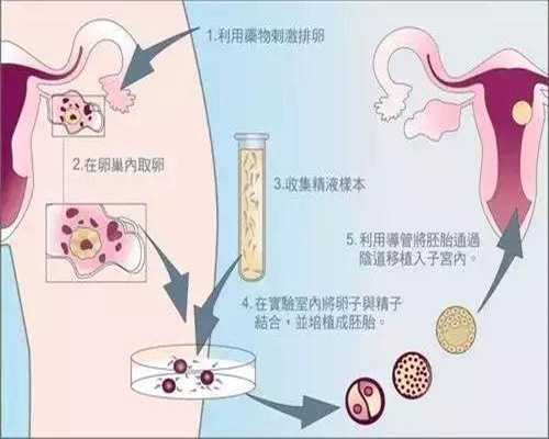 广州国内代孕需要多少钱-全国公立的供卵医院_耳聋基因会遗传吗，可以去泰国