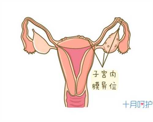 有人专门做代孕生意-广州供卵流程需要多久_广西试管婴儿一次要多少钱？听听