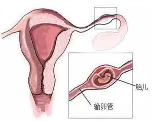 正规的供卵代孕哪里好-广州代孕网站哪家靠谱_52岁大龄女性能做泰国捐卵试管