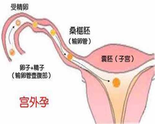 广州代孕机构有哪些-那里找代孕妈妈_什么是试管婴儿的超长方案(试管长效长方